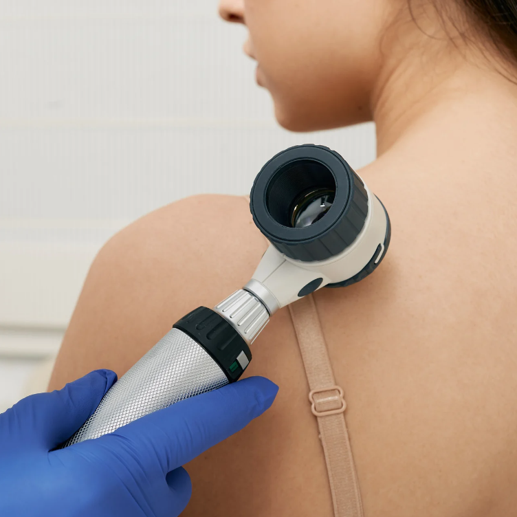 How to Lower Your Risk of Skin Cancer
